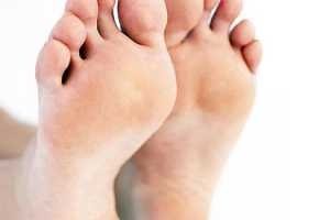 pies causas y remedios para los pies hinchados Causas y remedios para los pies hinchados pies